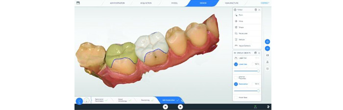 cerec-software-5x-700x225px
